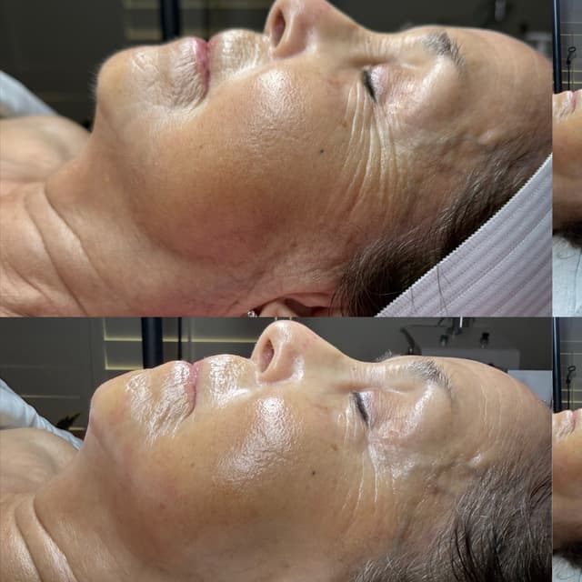 Results Membership at CreedsSkincare in Prosper, TX